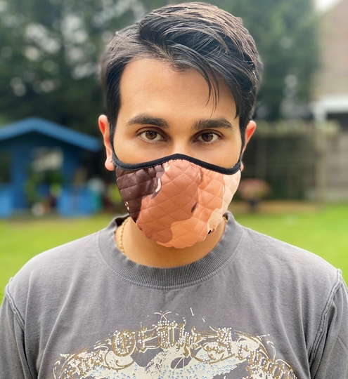 Singer Vee Kapoor  Says- I Hope More People With Vitiligo Are Accepted In The Entertainment  Industry